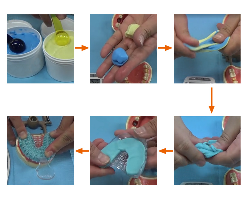 牙模模具硅橡膠操作 牙模模具硅橡膠操作